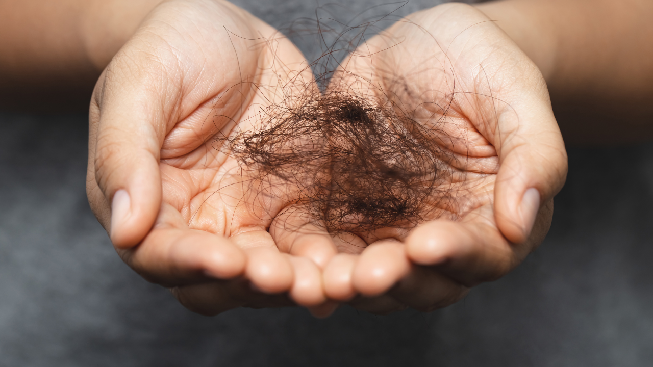 How FUT Hair Transplant Addresses Different Stages of Hair Loss