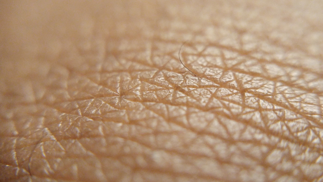 Say Goodbye to Sagging Skin: Thread Lift and Double Chin Liposuction