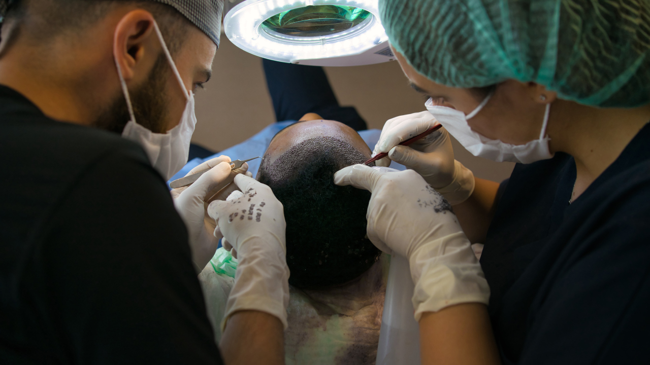 PRP Therapy vs. Hair Transplant: Which is Best for You